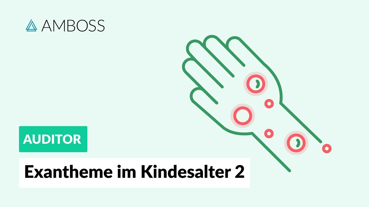 Exantheme im Kindesalter Teil 2 - Symptome und Behandlung - AMBOSS Auditor Fokus