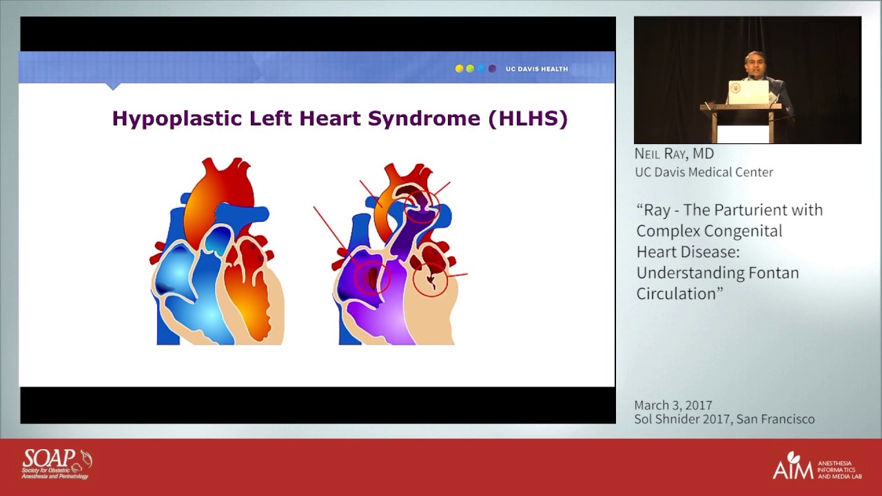 The Parturient with Complex Congenital Heart Disease - Neil Ray, MD