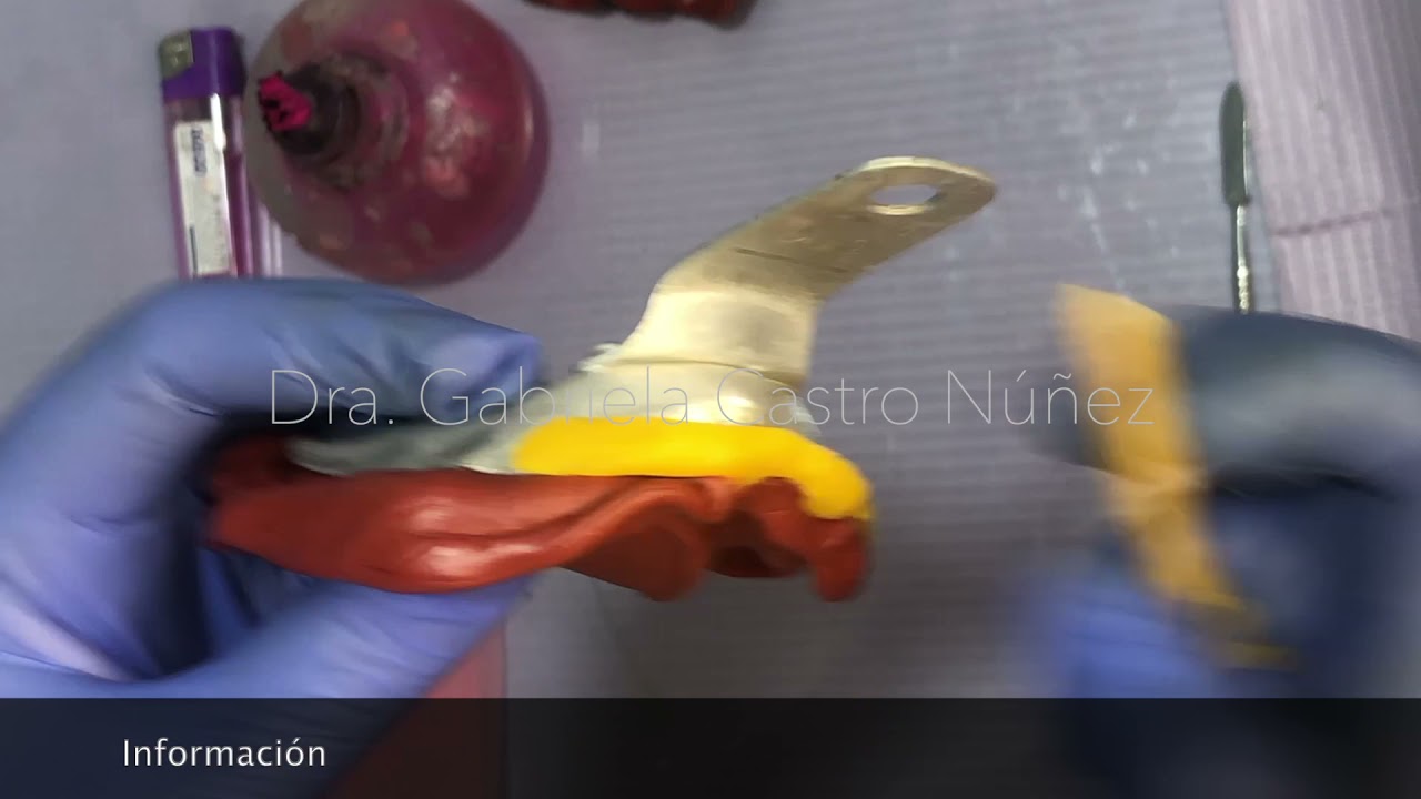 Impresión Odontológica con Godiva para pacientes edéntulos | Dra. Gabriela Castro Núñez