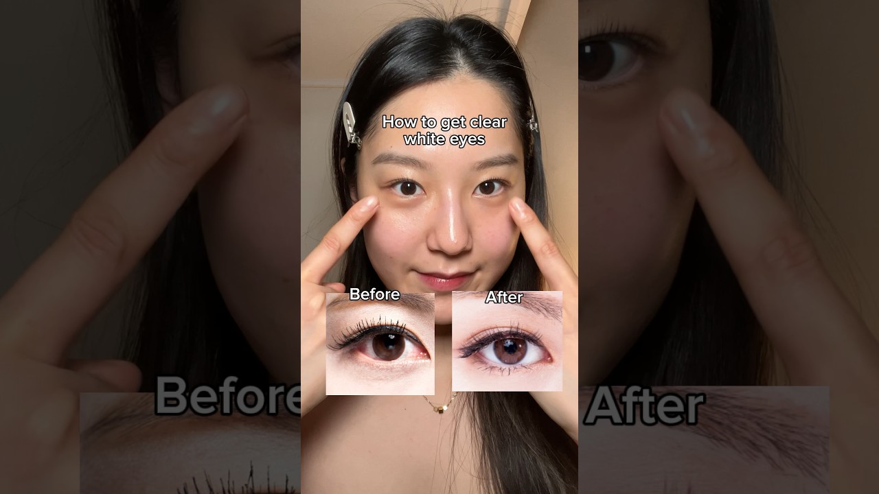 How to get clear white eyes 👀 #eyecare #eyehealth #koreanskincare