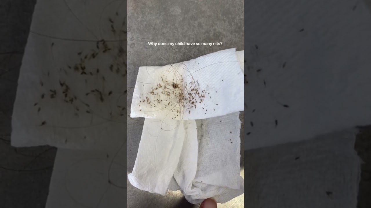 Сколько яиц могут отложить вши?