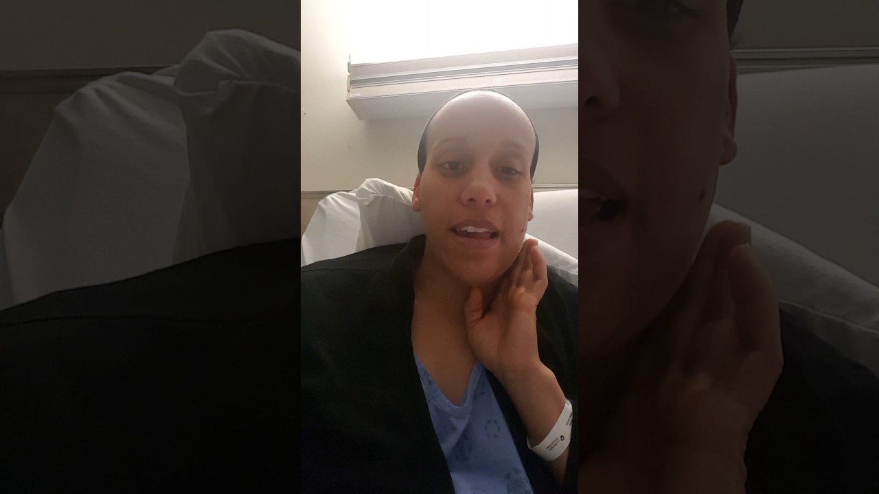 Carotid Paraganglioma- post surgery