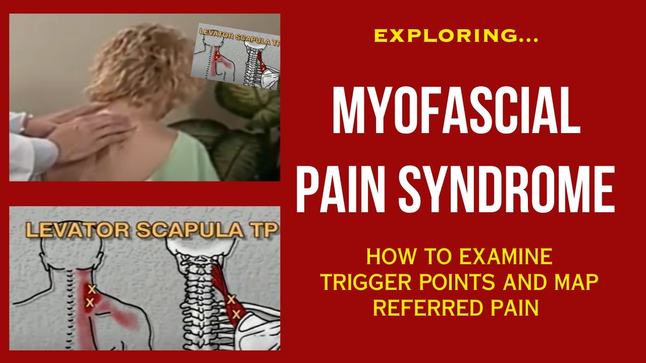 Myofascial Pain Syndrome -Trigger Point Exam
