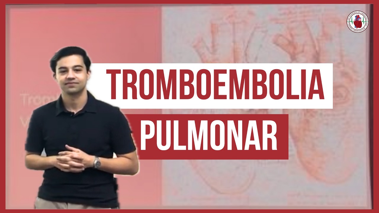 Tromboembolismo Venoso e TEP | Projeto Diretrizes | LACCCV UFMS
