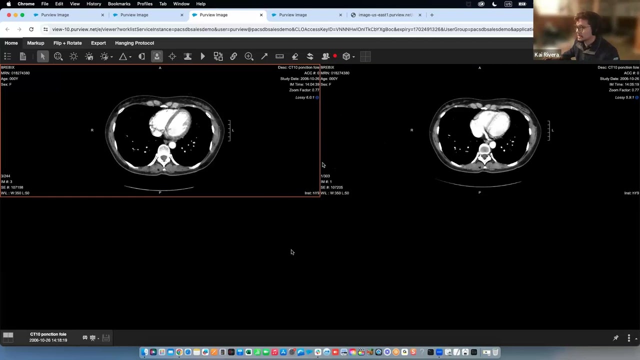 Purview Image™ Full Demonstration