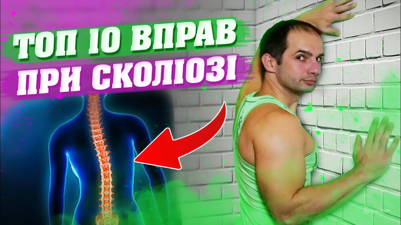 ТОП 10 ВПРАВ ПРИ СКОЛІОЗІ / КРАЩІ ВПРАВИ ПРИ СКОЛІОЗІ / ЯК ВИРІВНЯТИ СПИНУ? БОЛИТЬ СПИНА?