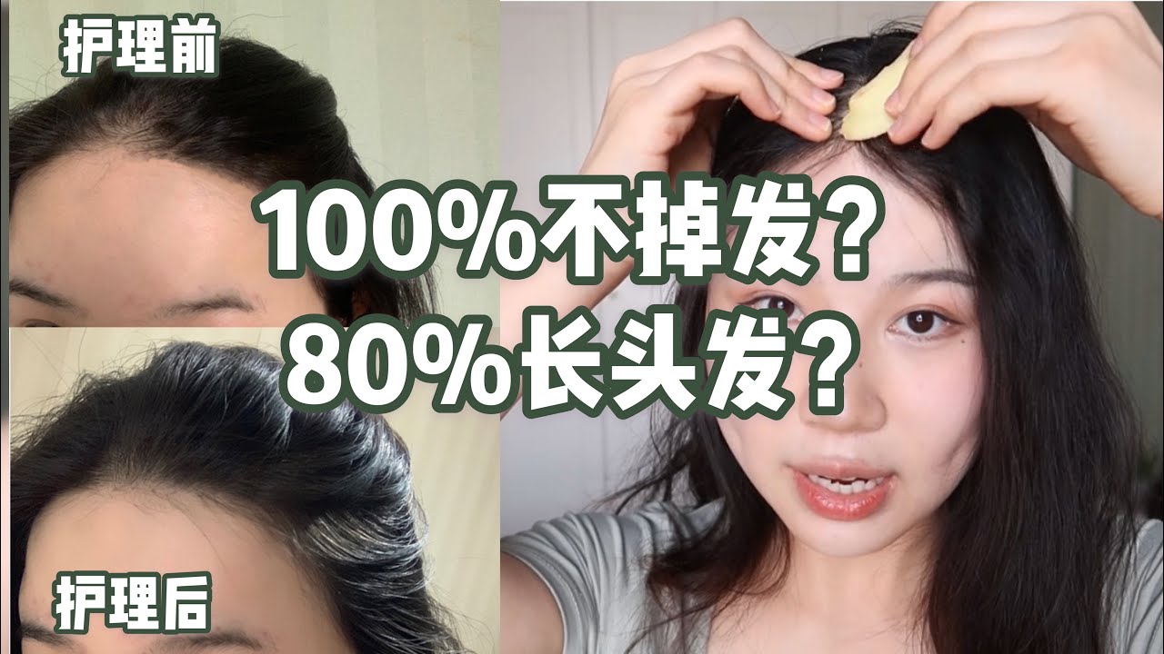【亲测有效】头皮护理秘诀 生发揭秘 有效！