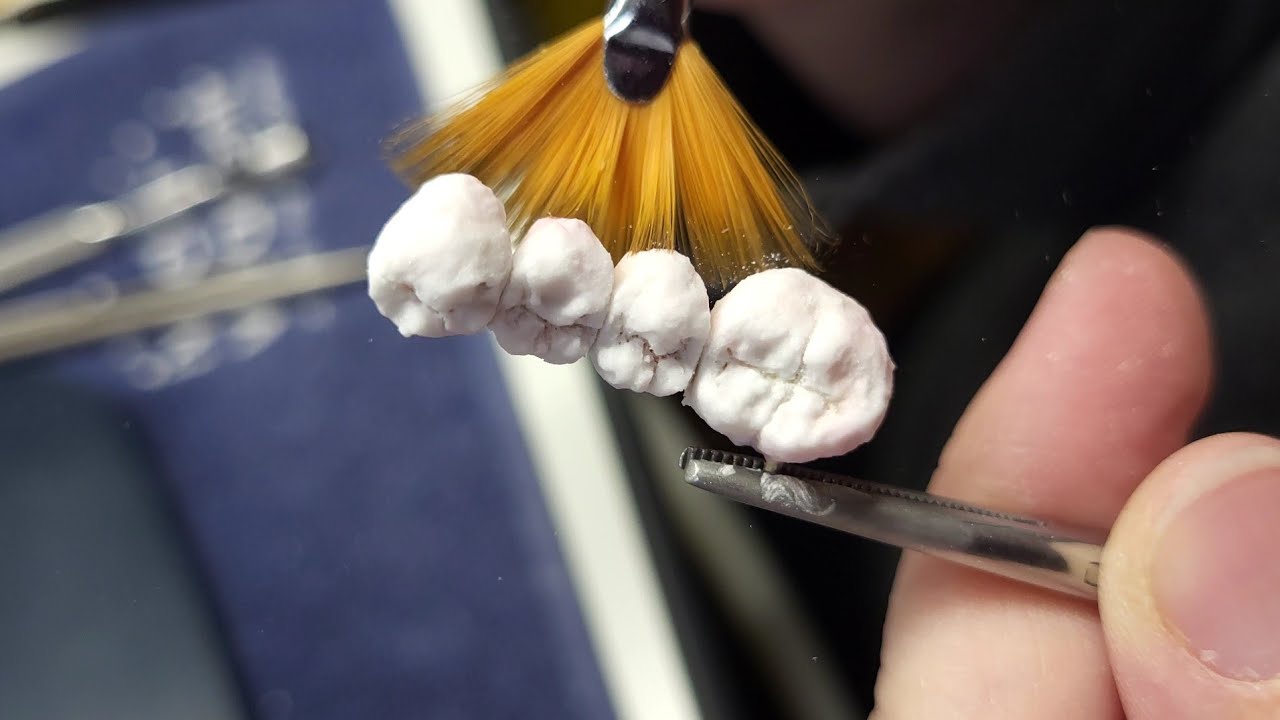 ASMR Metalo Ceramic Bridge Layered / IPS InLine / 4-units