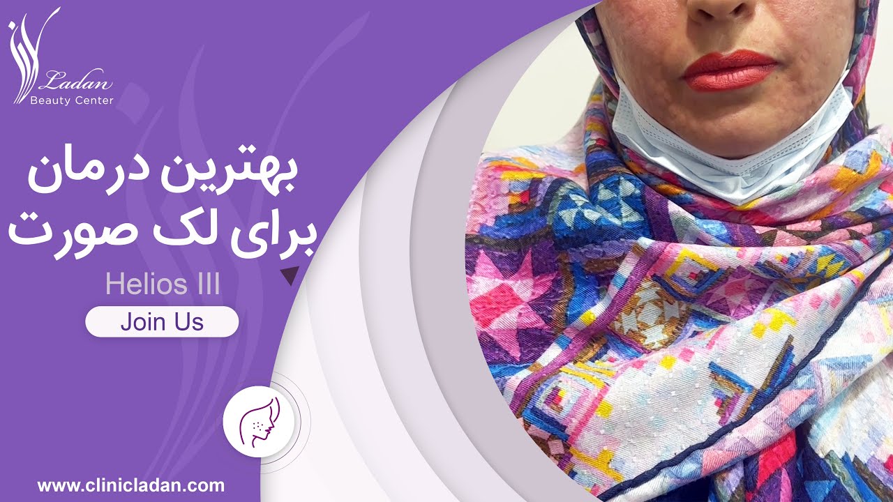 درمان لک با لیزر کیوسوئیچ