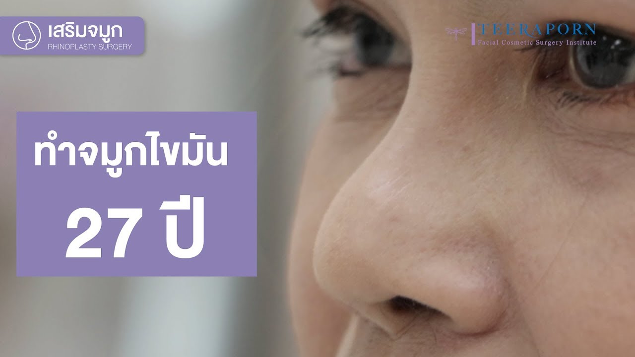 สุดยอด!! รีวิวทำจมูกไขมัน 27 ปี 