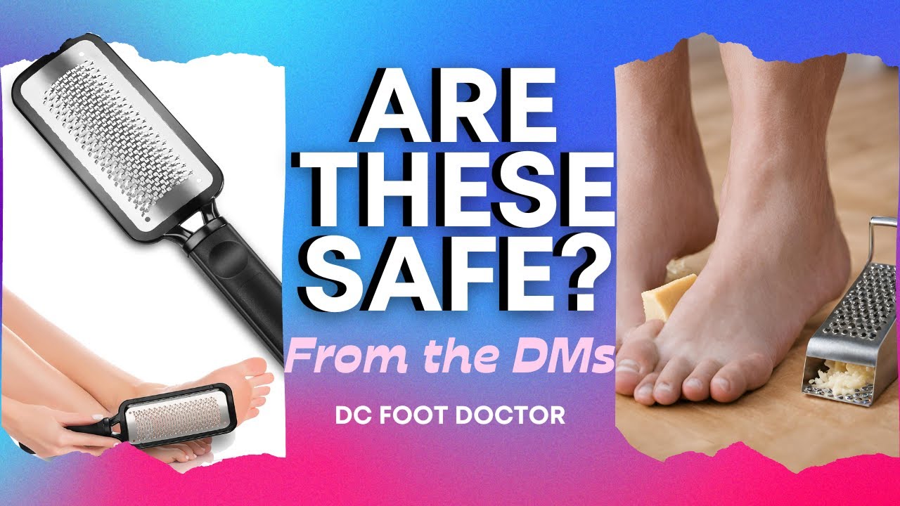 Безопасно ли это? Файлы для сырной терки: от DMs, эпизод 4