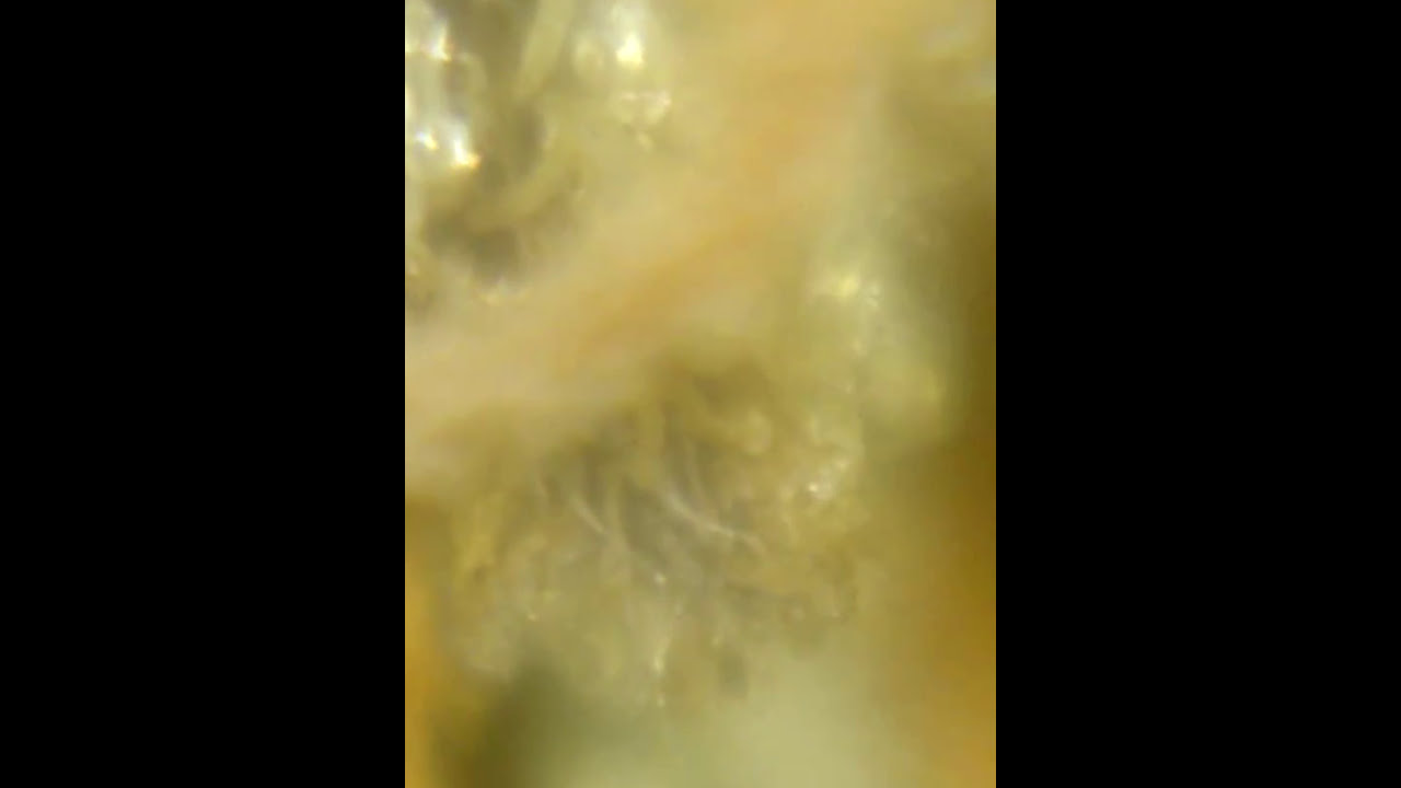 Tricomas vistos de cerca con una lupa zoom