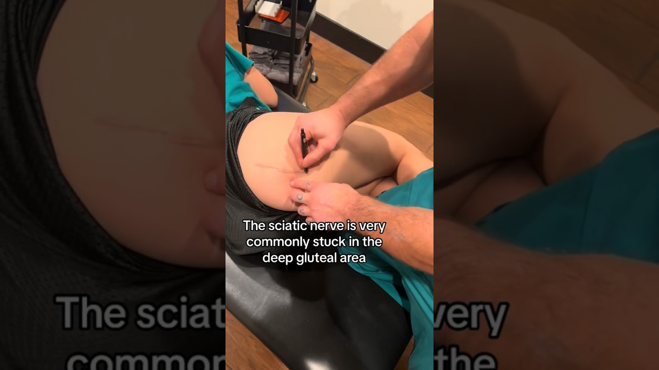 Sciatic Nerve Entrapment Dual Treatment for Chronic #sciatica Over 6 Months
