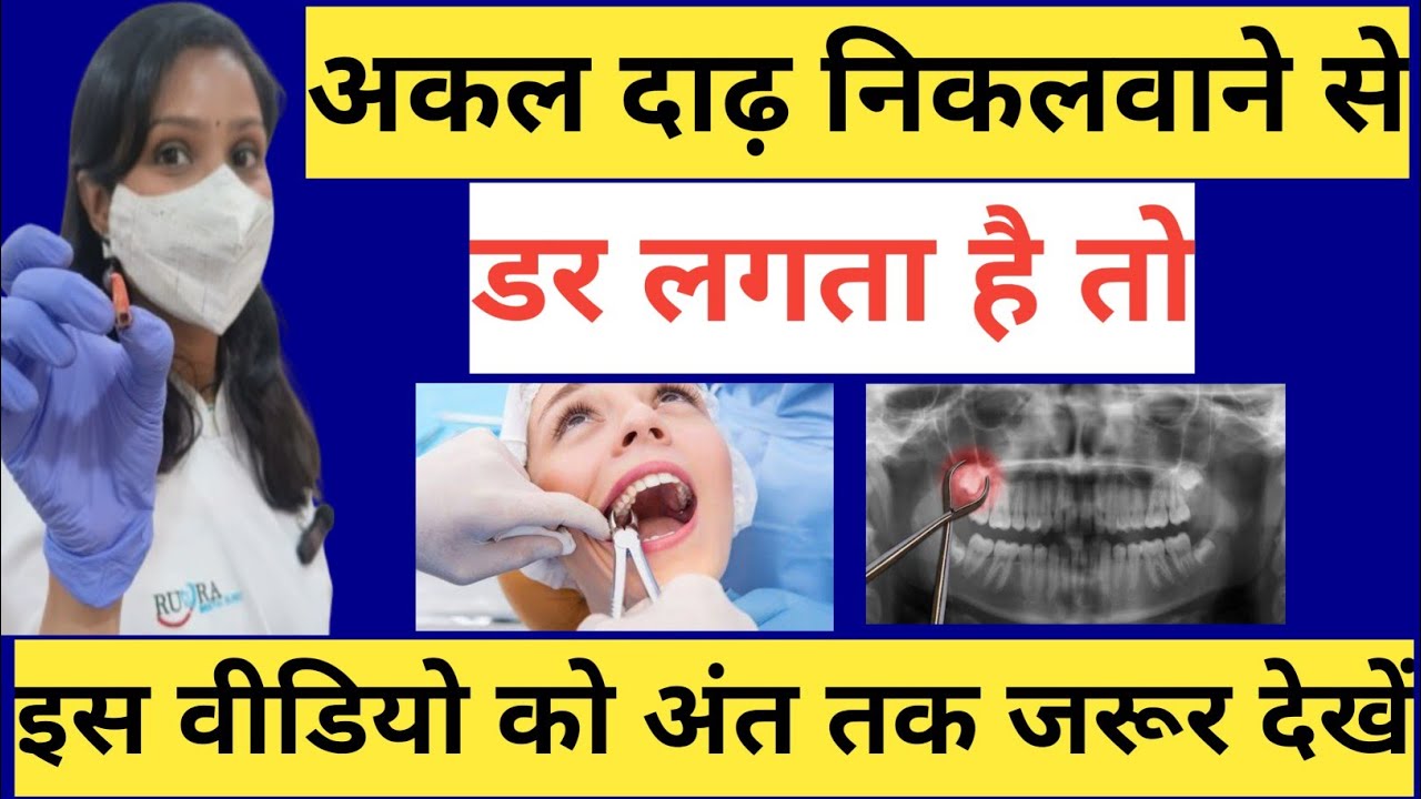 बिना दर्द के दांत कैसे निकालते हैं? |अक्कल दाढ़ का दर्द |Wisdom Tooth Extraction |Cost Of Extraction