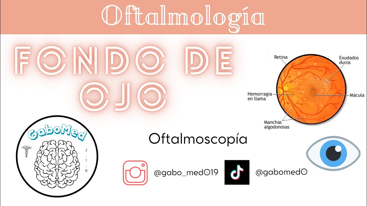 Oftalmoscopía / Fondo De Ojo