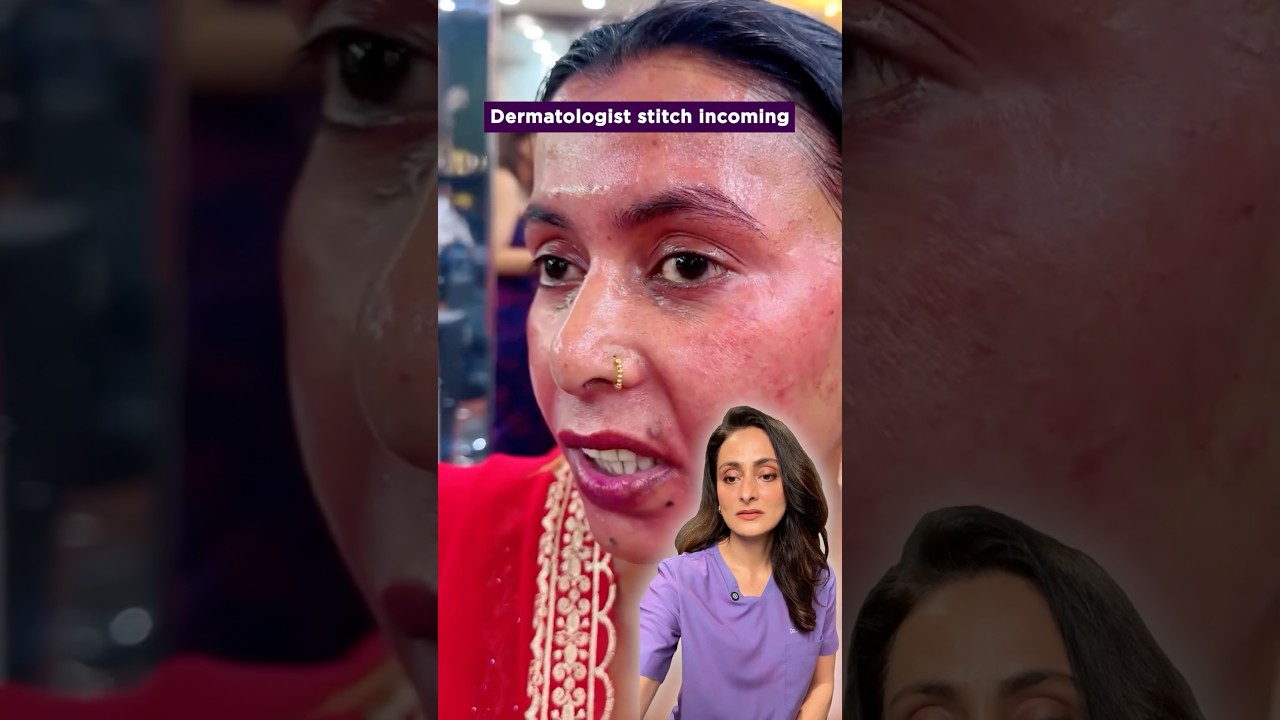 Fairness cream side effects