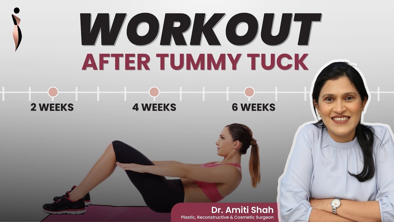 🙆 Exercises After the Tummy Tuck | Abdominoplasty Surgery Post Op Care 🌟 #shorts #tummytucksurgery