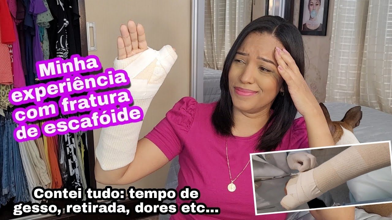 Fratura de escafóide/punho - como foi