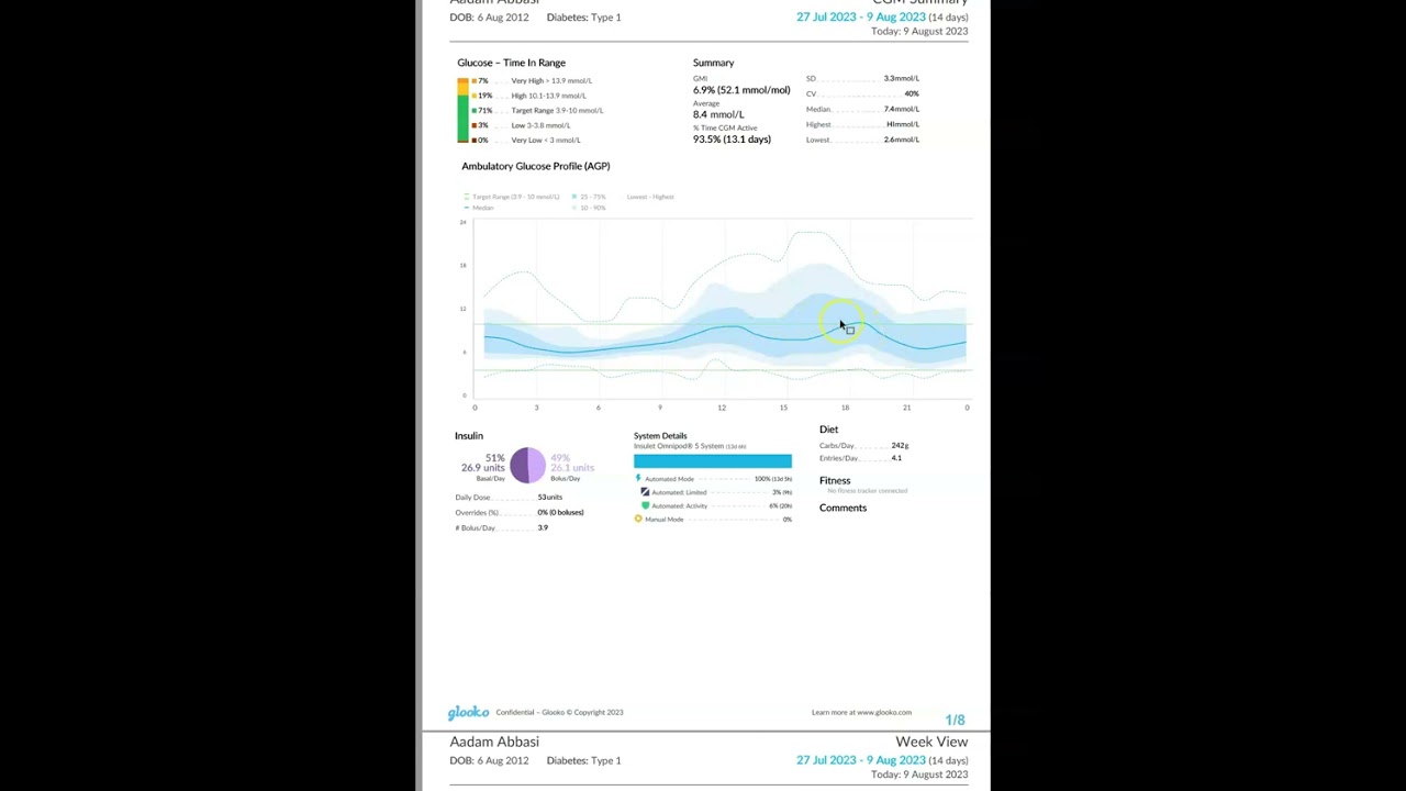 Omnipod 5  - creating and assessing a download