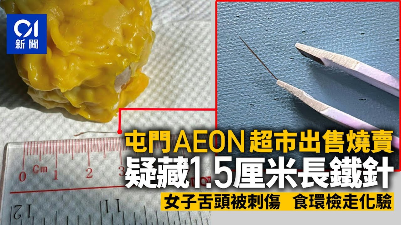 【01秒看新聞】屯門超市燒賣疑藏1.5厘米長鐵針　女子舌頭被刺傷　食環檢走化驗｜01新聞｜燒賣｜鐵針｜食安｜屯門｜Aeon