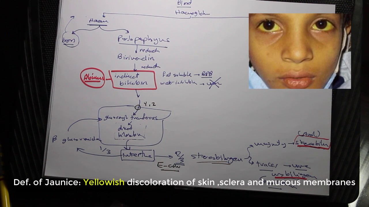 Pediatrics Haematology - Volume II - Part 1 (Haemolytic Anemia) - Islam Raky