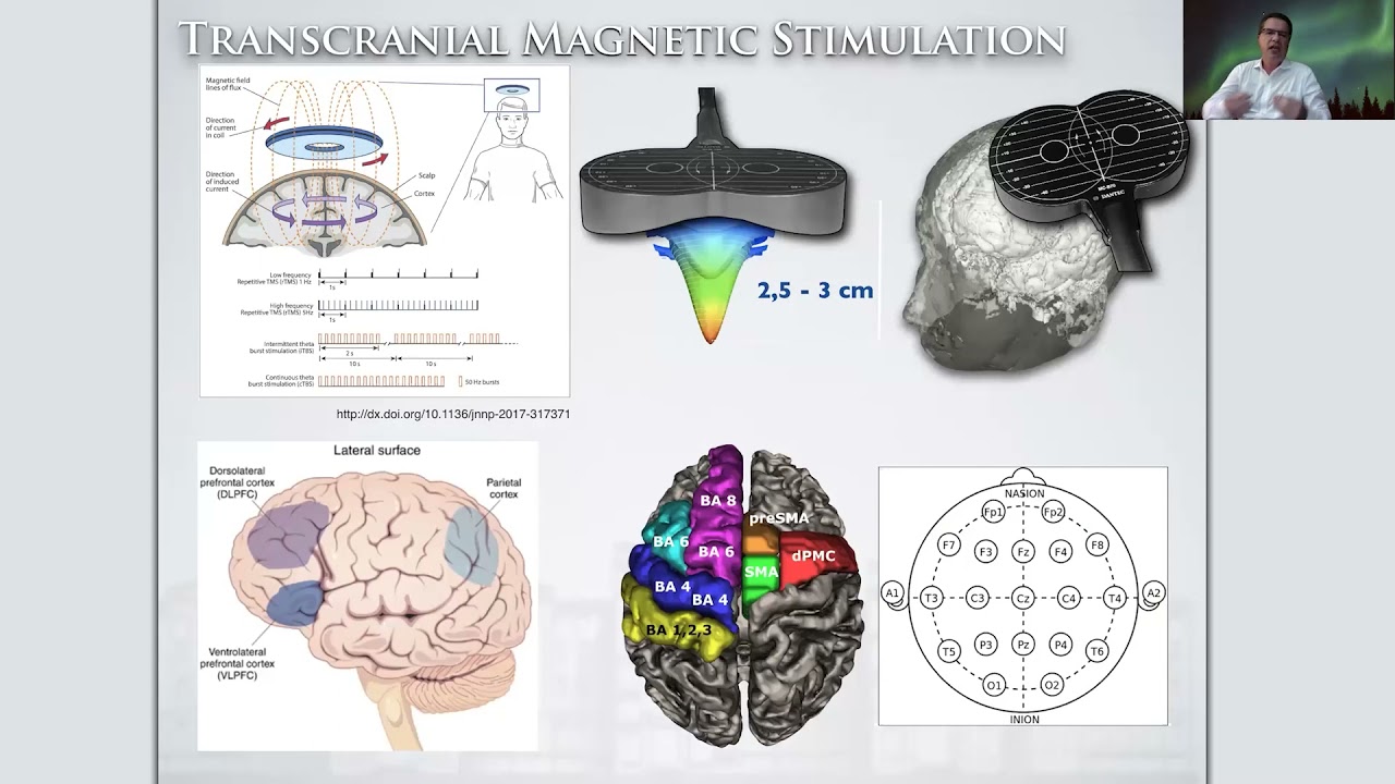Curso de Estimulación Magnética Transcraneal