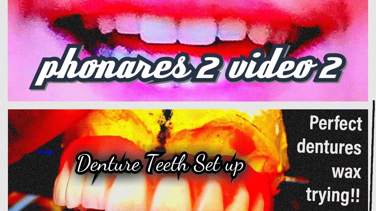 Dentures  Teeth set up  Tutorials part 2 Phonares II