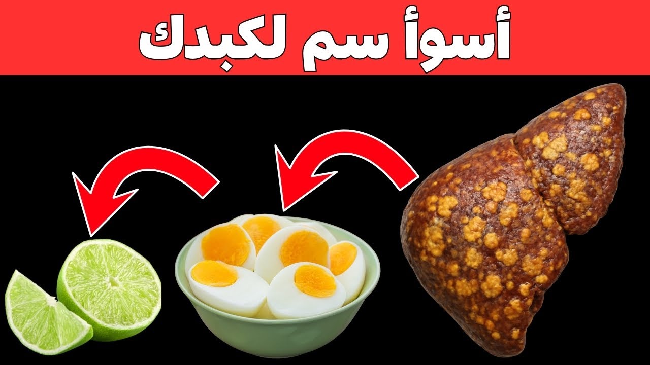 هذه الأطعمة الـ 17 تدمر كبدك وأنت لا تدري! | احذرها قبل فوات الأوان #الكبد_الدهني