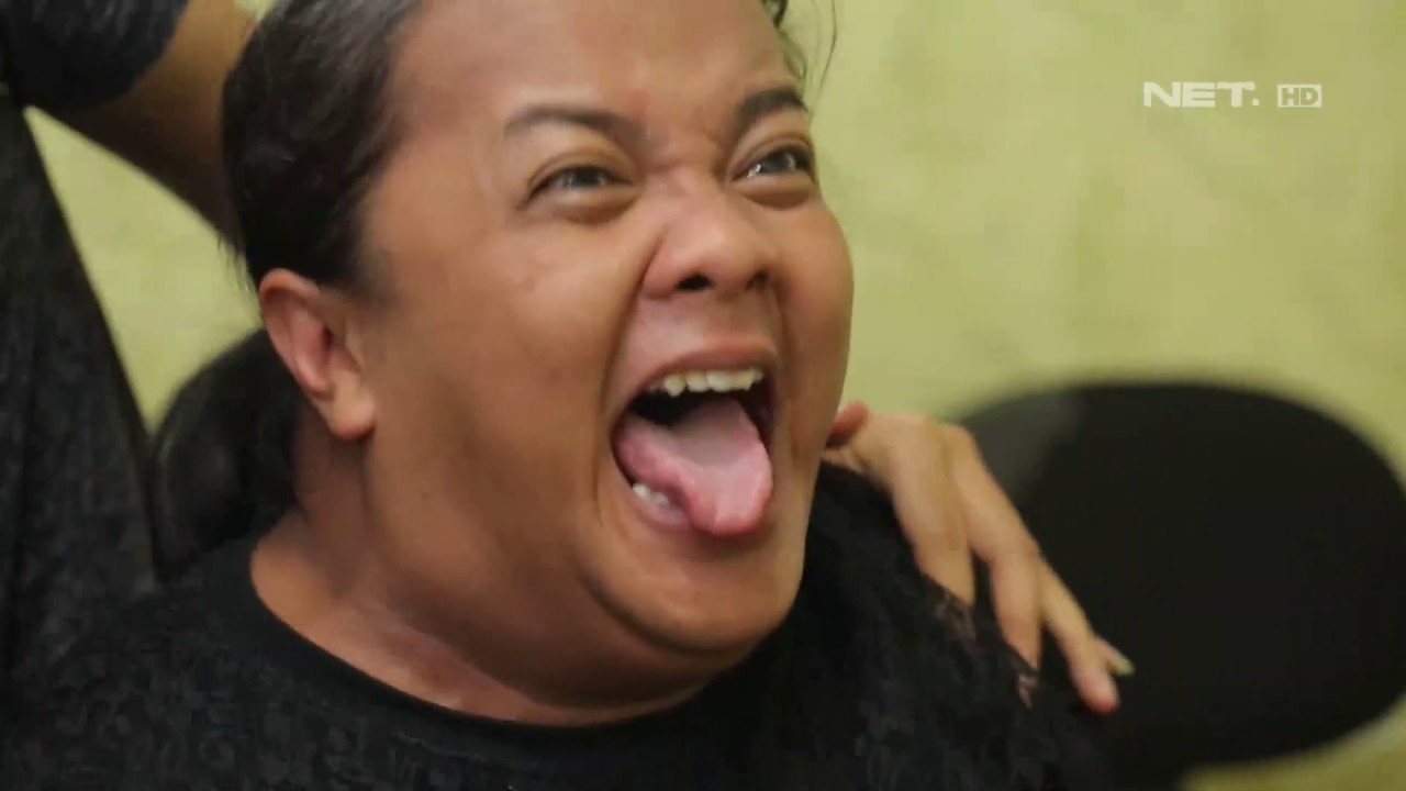 Karena Pola Makan yang Ngawur Pasien Ini Alami Banyak Penyakit