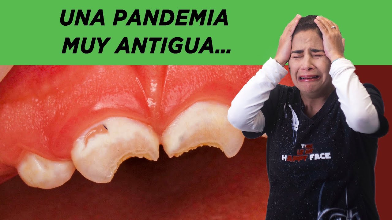 Caries en beb&eacute;s: una pandemia devastadora&hellip;