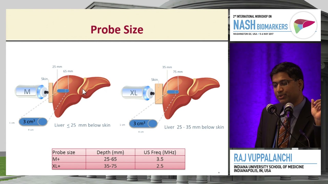 Transient elastography & other techniques | Raj Vuppalanchi, MBBS