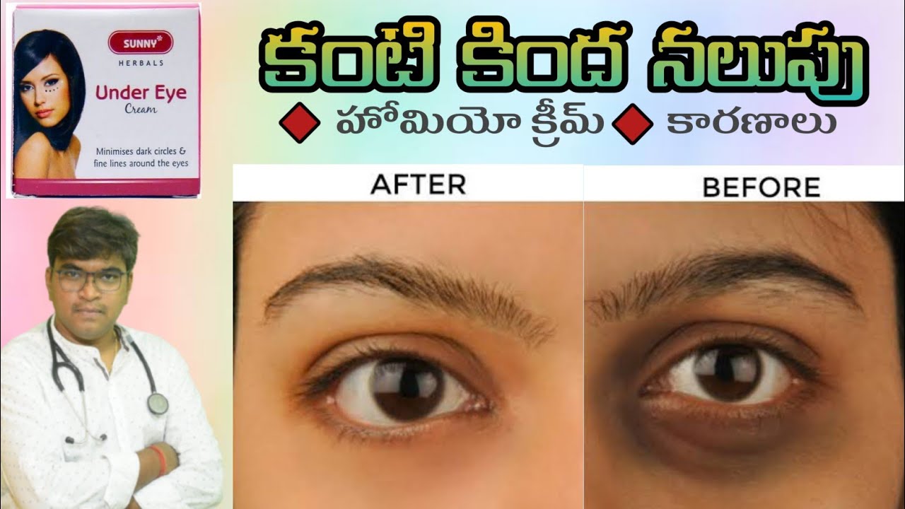 How To Treat Dark Circles Under Eyes pigmentation treatment Under Eyes Dr Lakshmi Deepak MD Homeo