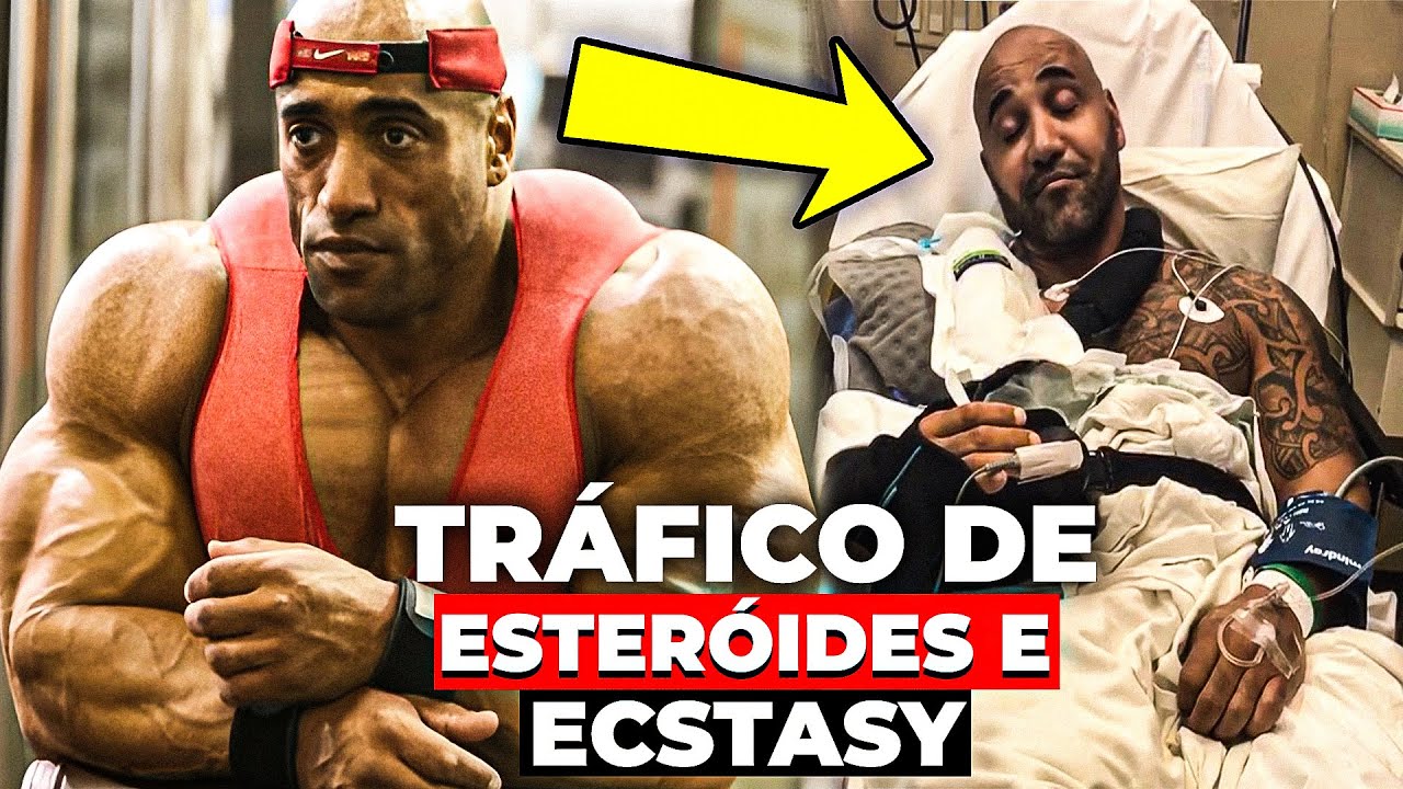 O que Aconteceu com Dennis James?!