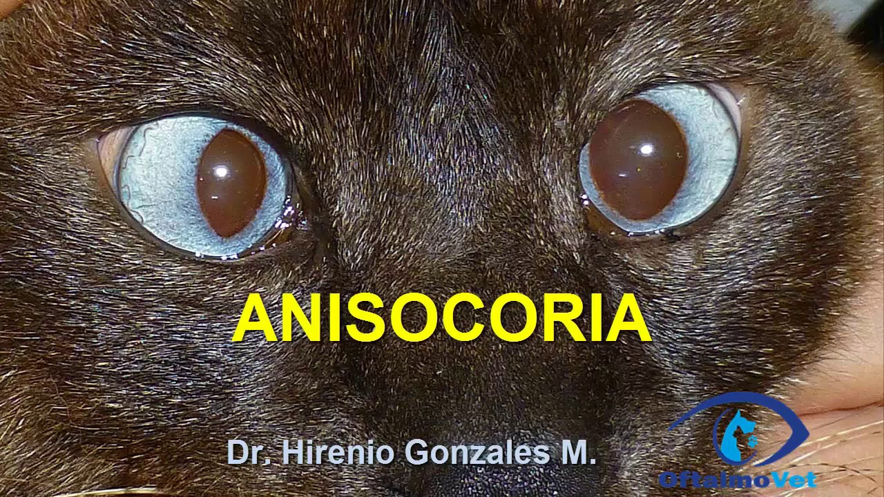 Anisocoria