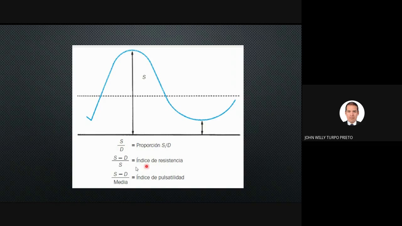 Doppler en Obstetricia