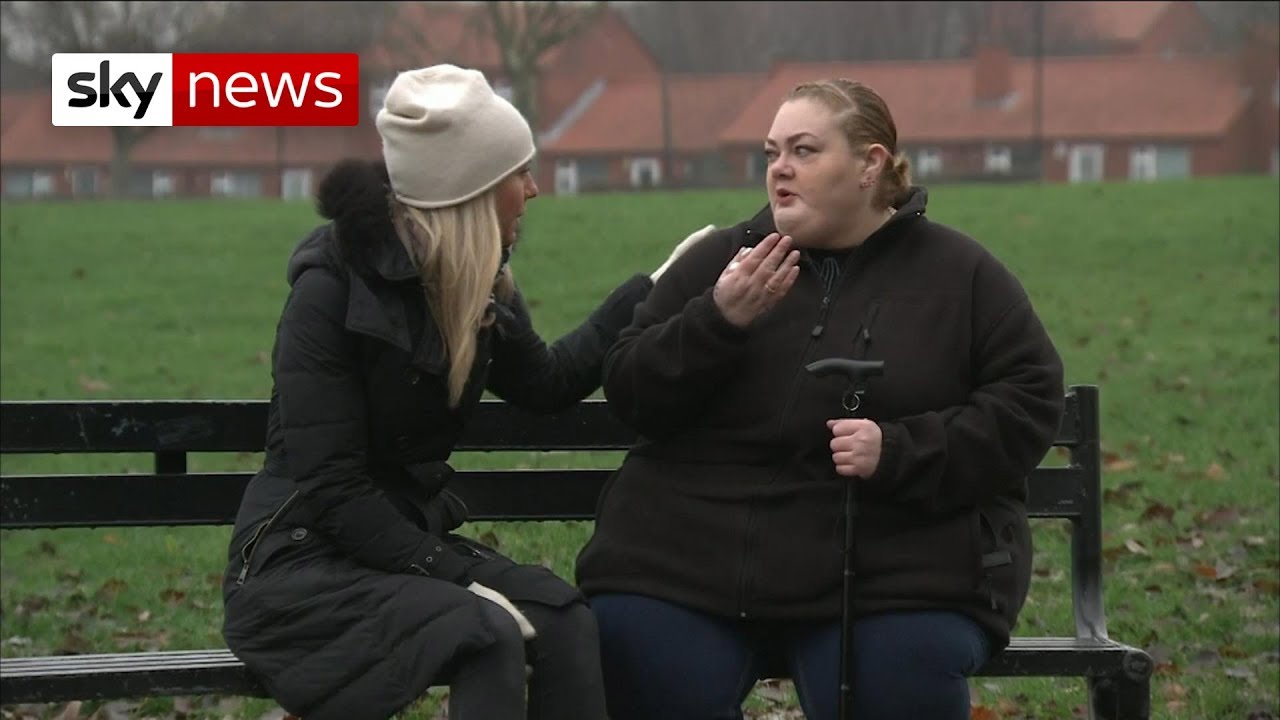Obesity patients left struggling after NHS cuts