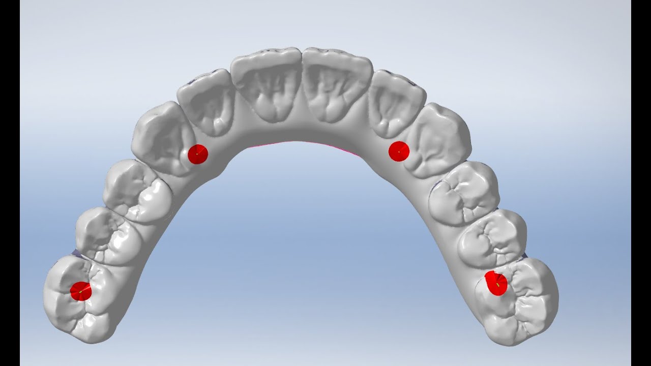 Overstructure-Antrinė Dalis Millbox 2023