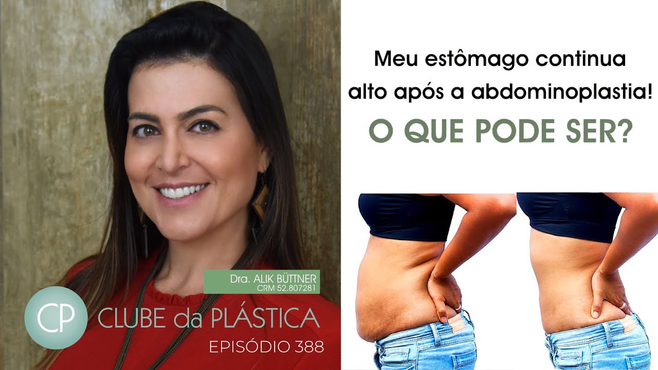 Clube da Plástica: Meu estômago continua alto após a abdominoplastia! O que pode ser?
