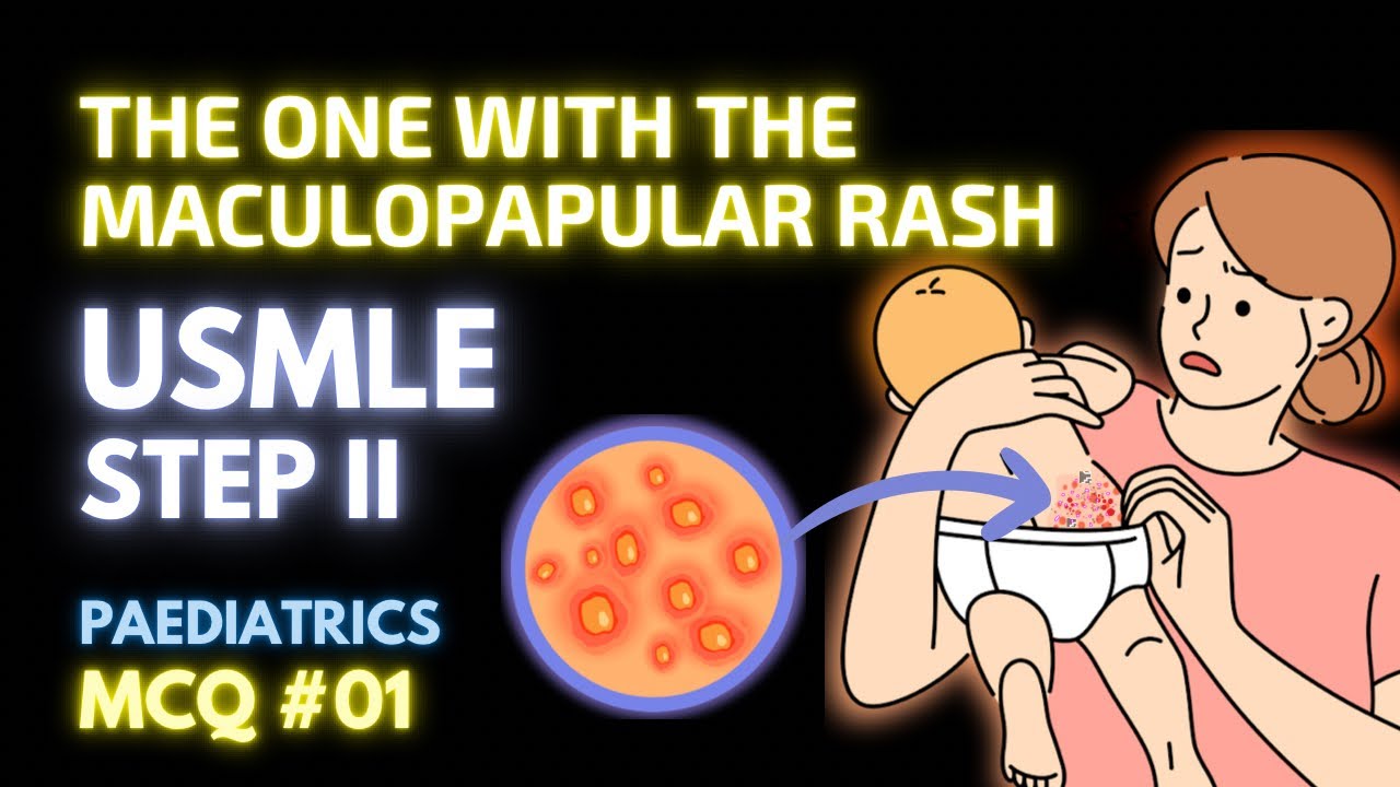 USMLE Pediatrics MCQ #01: The EPITOME of Pediatric USMLE Prep