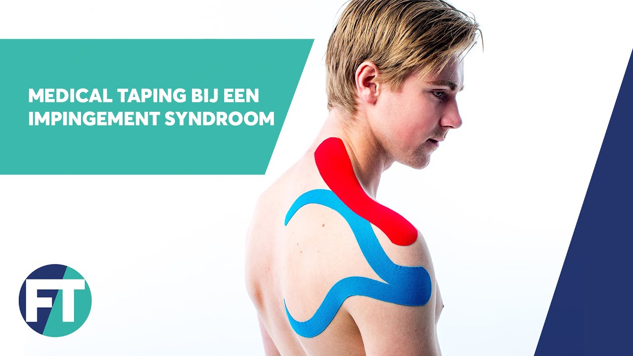 Impingement Syndroom tapen | Medical Taping | FysioTape