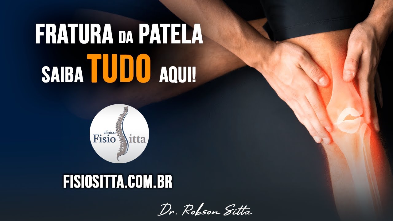 JOELHO FRATURA da PATELA CIRURGIA e TRATAMENTO de FISIOTERAPIA RÓTULA Clínica Dr. Robson Sitta