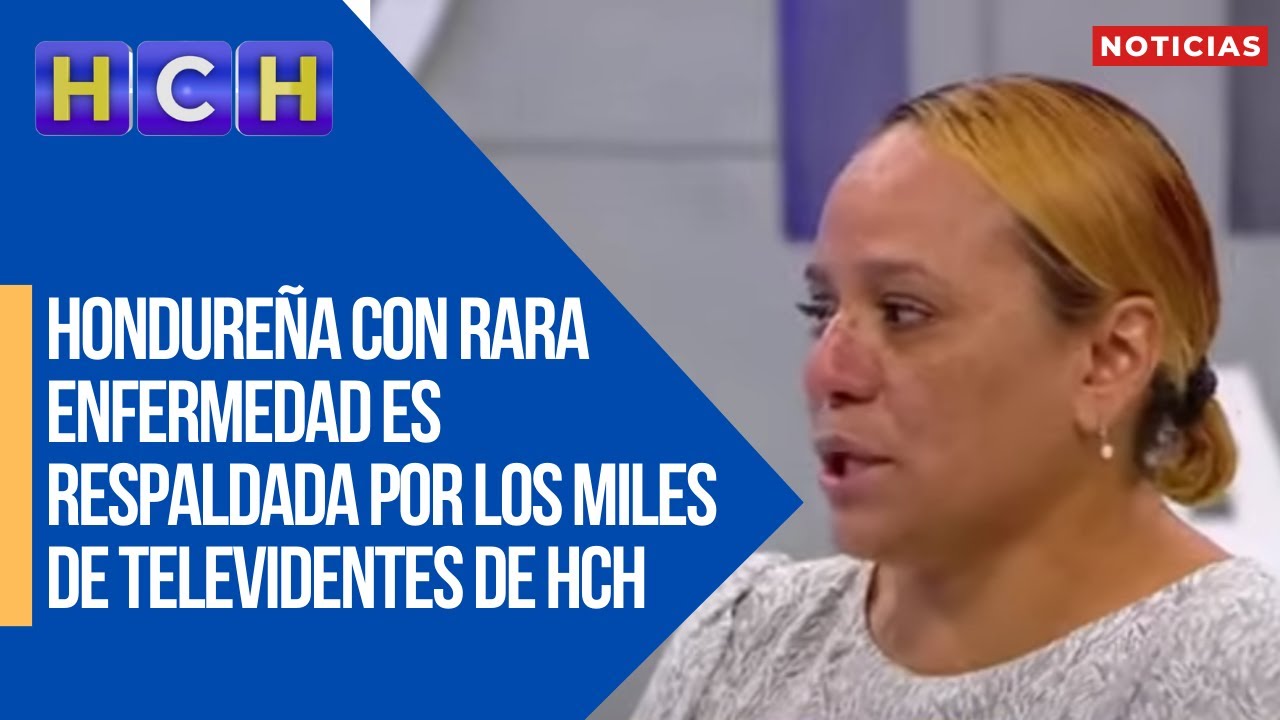 Hondureña con rara enfermedad es respaldada por los miles de televidentes de HCH