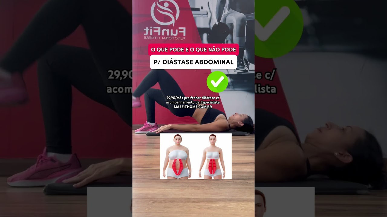 3 EXERC&Iacute;CIOS QUE PODEM E 3 QUE N&Atilde;O PODEM PRA DI&Aacute;STASE ABDOMINAL #diastase