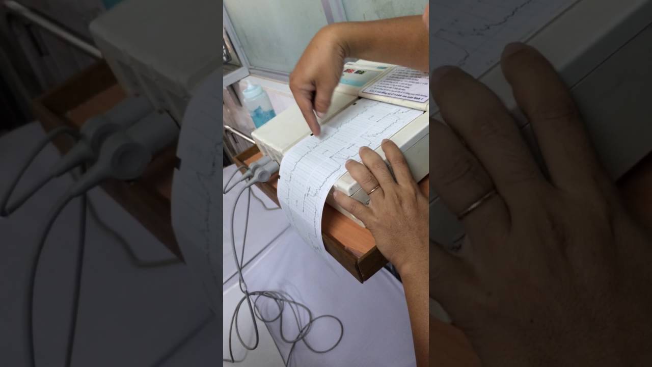 Cách đọc CTG