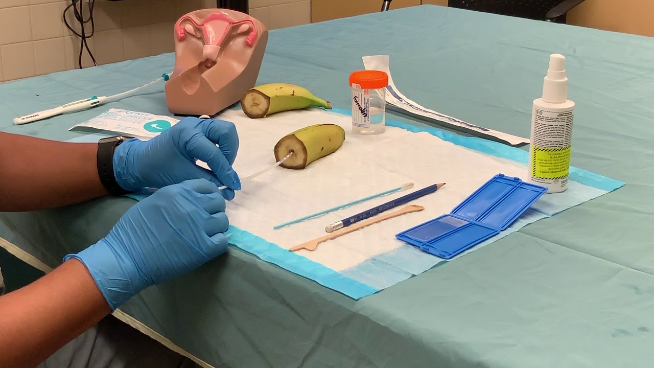 Gynecologic Procedures Endo Bx