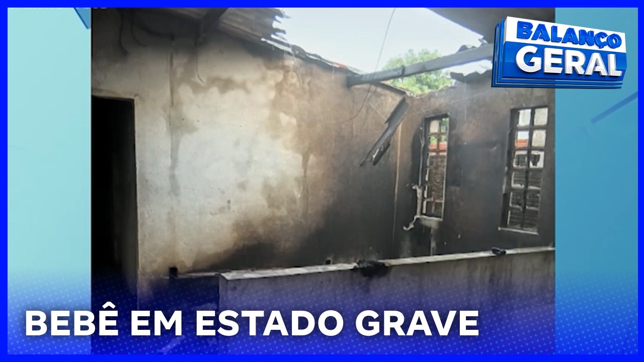 Criança de 1 ano segue em estado grave após incêndio causado por álcool em Birigui