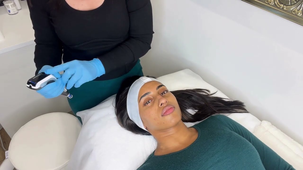Transform Your Skin: Advanced Acne Scar Treatment at HUSH Clinical