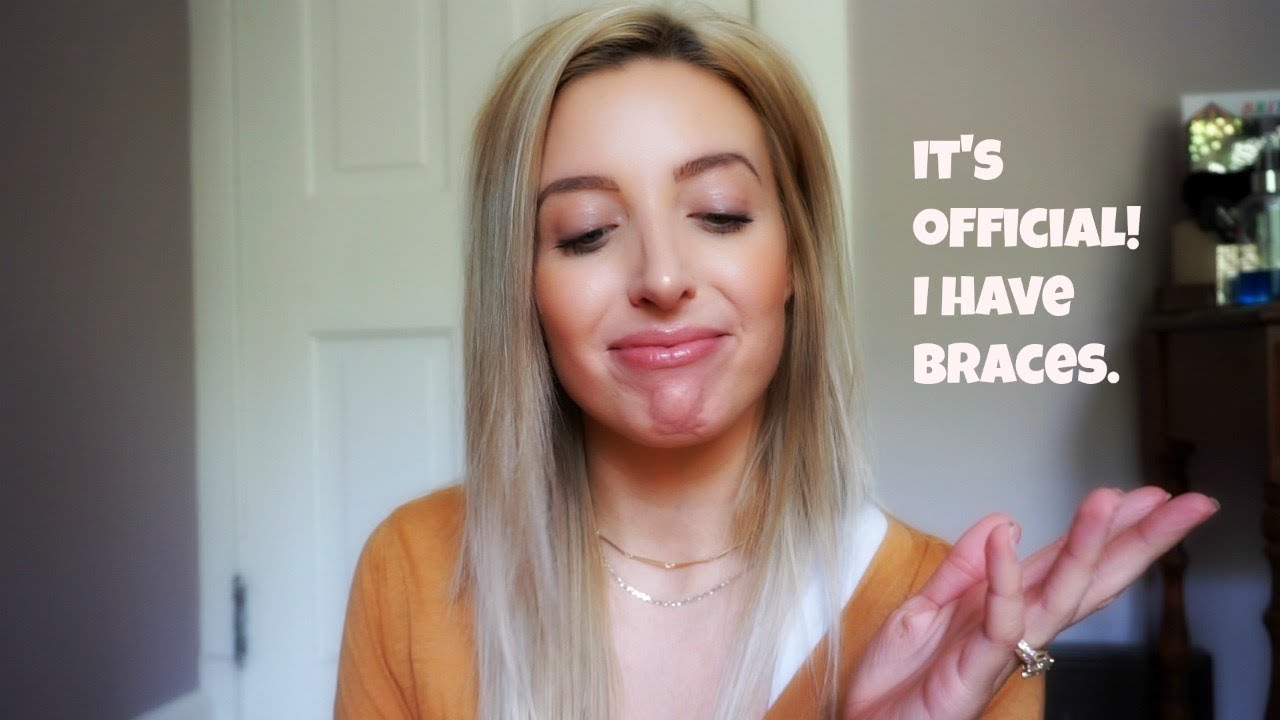 Adult Braces | REVEAL! | App. 7