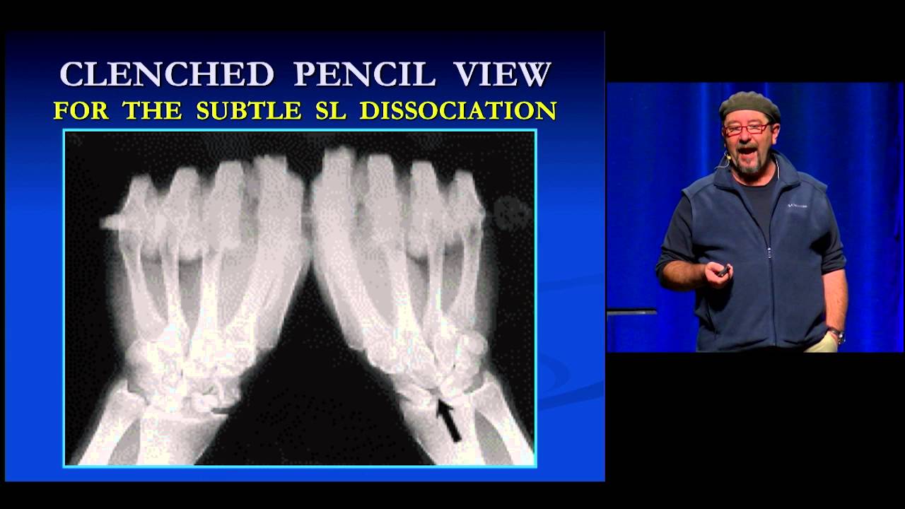 EEM 2015 - And 1 - Xray views to detect occult injuries