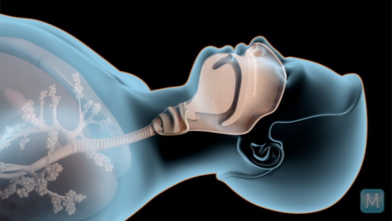 Sleep Apnea verses Snoring | Match Health